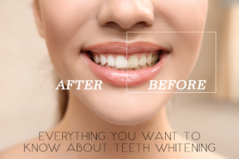 Albuquerque dentist, Dr. Shamaine Giron at ABQ Dentistry and Wellness, explains the basics of keeping your teeth pearly white and goes over what you can do if they’re not.