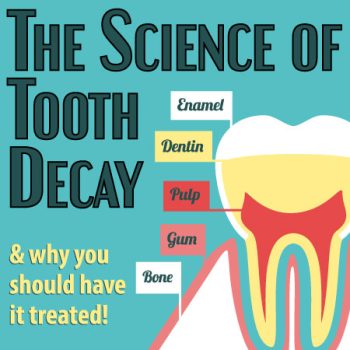 Albuquerque dentist, Dr. Keri Giron at ABQ Dentistry and Wellness, discusses the science of tooth decay: what it is and what you can do to prevent it.