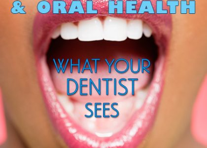 Diabetes & Oral Health: What Your Dentist Sees (featured image)