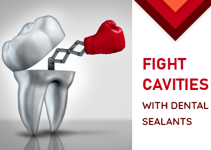 How to use Dental Sealants to Fight Cavities (featured image)