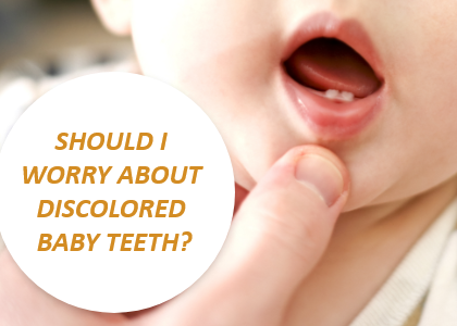 Should You Worry about Discolored Baby Teeth? (featured image)