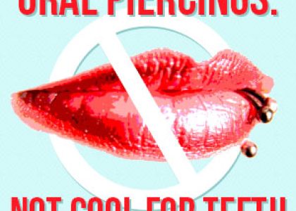 Oral Piercings: Not Cool for Teeth (featured image)