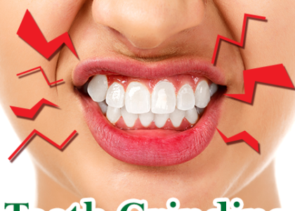The Truth About Teeth Grinding (featured image)