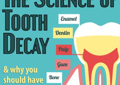 The Science of Tooth Decay (featured image)