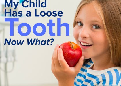 My Child Has a Loose Tooth—Now What? (featured image)